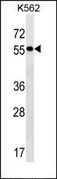 FRMD8 antibody
