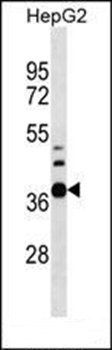 RPUSD1 antibody