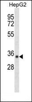 SDR39U1 antibody