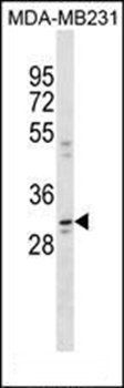 CCDC28A antibody