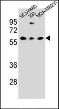 CLEC17A antibody