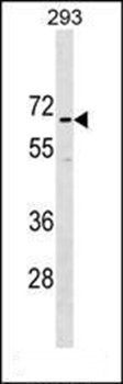CCDC151 antibody