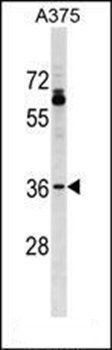 OR51T1 antibody