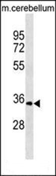 UCK1 antibody