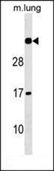 NAT15 antibody