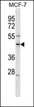 SCML1 antibody