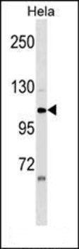 ZNF33A antibody