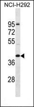 OR2T5 antibody