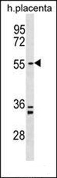 PAPD5 antibody