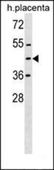 ZNF558 antibody