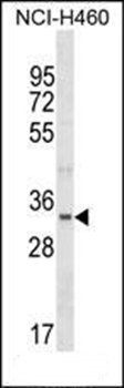 FBLL1 antibody