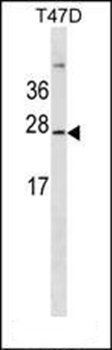GKN3P antibody