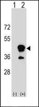 CD1B antibody