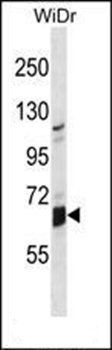 GLB1L antibody