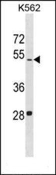 LDHAL6B antibody