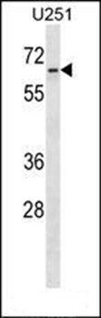 ZNF768 antibody