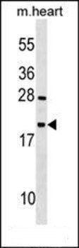 TEX12 antibody
