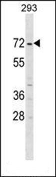 ZNF643 antibody