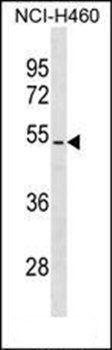 PTEN (T383/T382) antibody