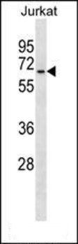 GALNT14 antibody