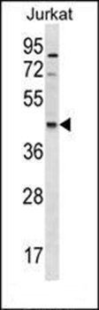 GDE1 antibody