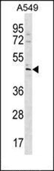 TBC1D20 antibody