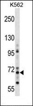 ZNF256 antibody