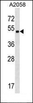 ZNF559 antibody