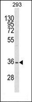 SSBP2 antibody