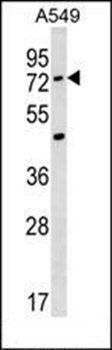 ACSM2A antibody