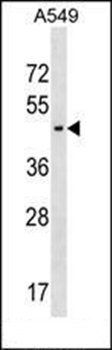 AGPAT5 antibody
