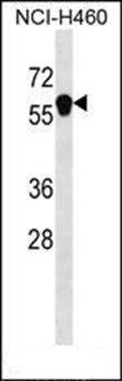 ANKDD1B antibody