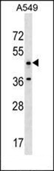 ANKRD61 antibody