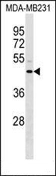 ANXA8L2 antibody