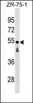 KT81L antibody