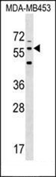 LRRTM2 antibody