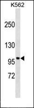PPP1R9A antibody