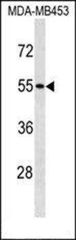 SKAP1 antibody