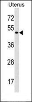 PLA2G3 antibody