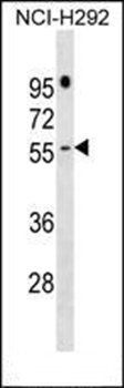 PRAMEF16 antibody