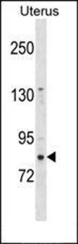 ZNF853 antibody