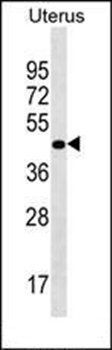 PRR25 antibody