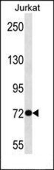 ANKRD56 antibody