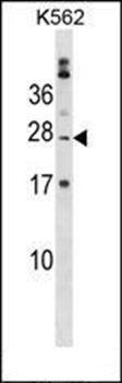 PABPC1L2B antibody