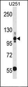 THBS3 antibody