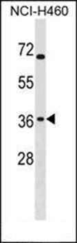 ST6GALNAC4 antibody