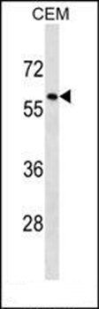 TRIM58 antibody