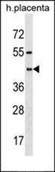 PSG6 antibody