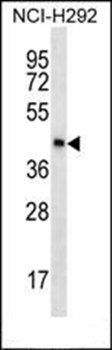 SPESP1 antibody