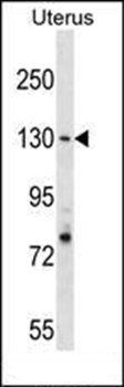 RFC1 antibody